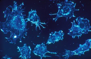 Cancer_cells_%281%29