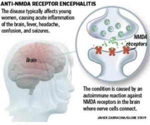 Anti-NMDA-Receptor-Encephalitis