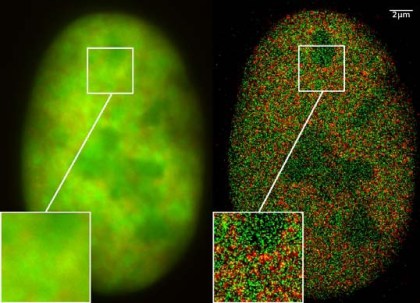 GFP_Superresolution_Christoph_Cremer