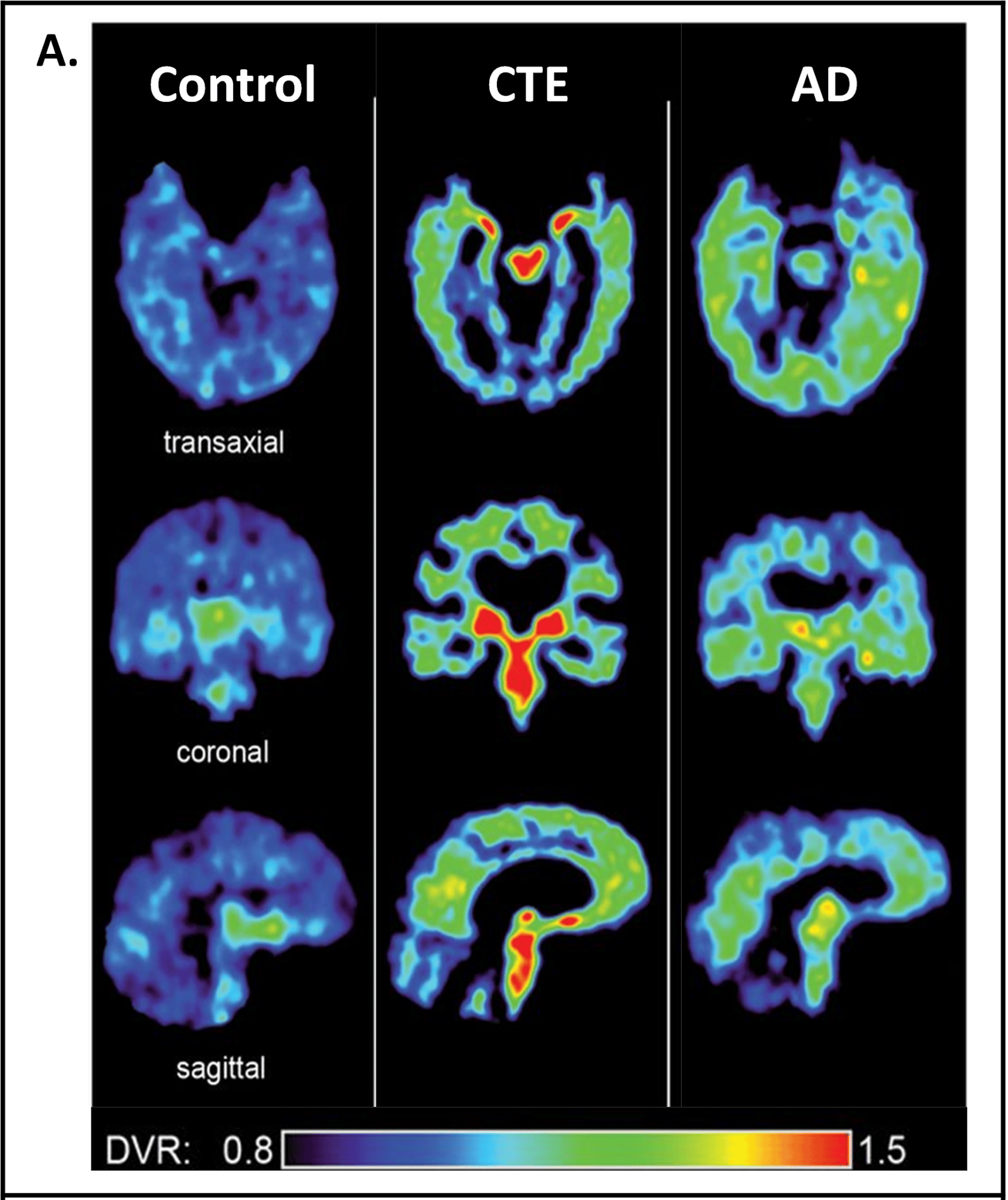 Tackling concussions head-on with safer sports equipment | Lions Talk ...
